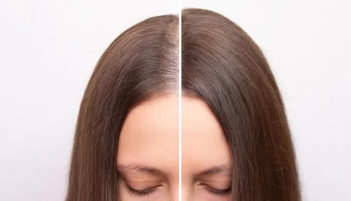 GFC Hair Treatment: The Next-Generation Solution for Hair Loss and Hair Regrowth